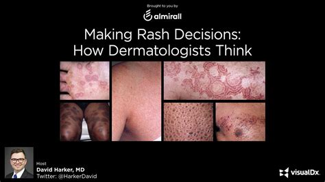 Making Rash Decisions How Dermatologists Think Dr David Harker