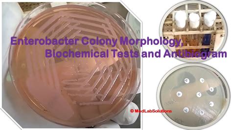 Enterobacter Colony Morphology Biochemical Tests And Antibiogram