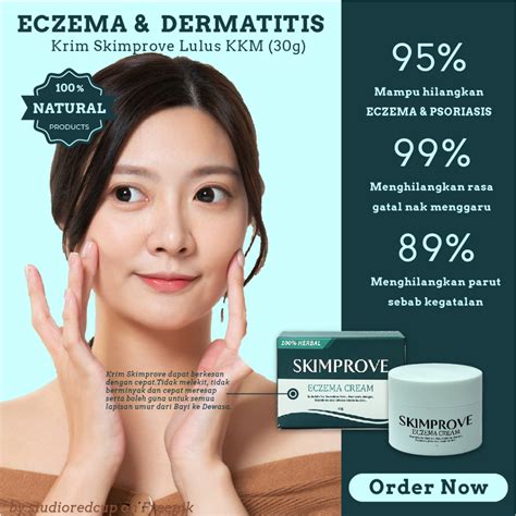 Krim Gatal Skimprove Lulus Kkm Eczema Psoriasis Ruam Bayi Kurap