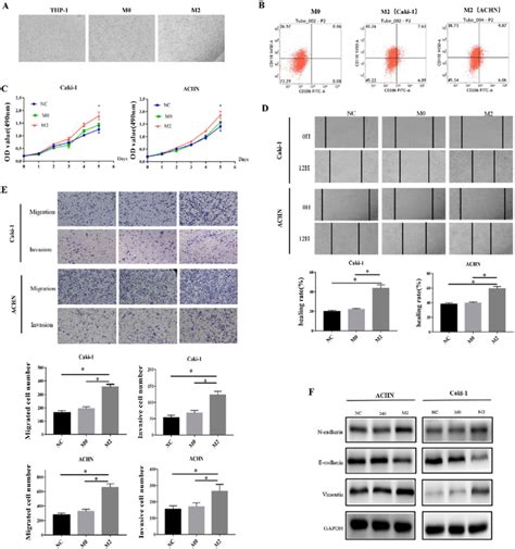 Thp Derived M Macrophages Promote Emt In Ccrcc Cells A Cell