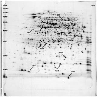 The Representative Two Dimensional Gel Electrophoresis Of Anti Vegf