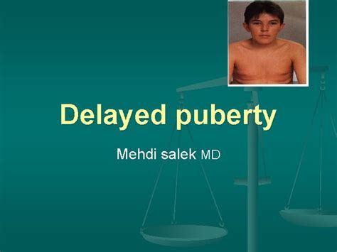 Delayed Puberty Mehdi Salek Md Delayed Puberty Initial