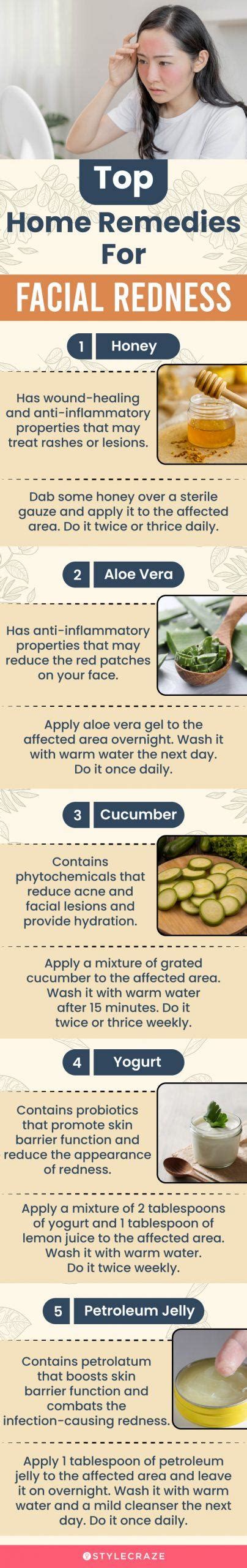 Home Remedies To Reduce Redness On The Face Prevention Tips