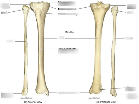 Kin Exam Diagram Fibula Tibia Diagram Quizlet