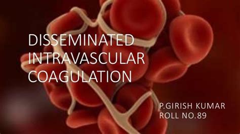 disseminated intravascular coagulation