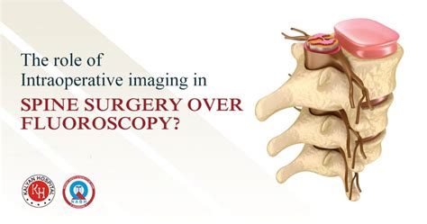 What Is The Role Of Intraoperative Imaging In Spine Surgery Over