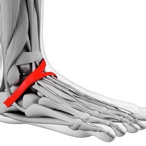 Anterior Cruciate Ligament Tear Ct Scan Photograph By Du Cane Medical