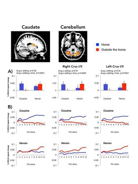 Caudate And Cerebellum IMAGE EurekAlert Science News Releases