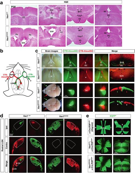 Ipsilaterally Biased Rgc Axon Projection In Vax1 Aaaa Mice A Coronal