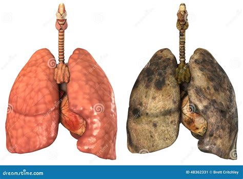 Smoker Human Lungs