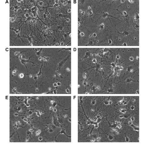 Neuroprotective Effect Of Ergothioneine Egt On Cisplatin Induced