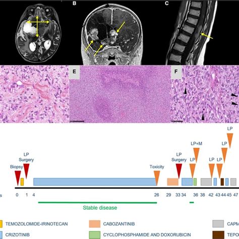 Radiological And Histopathological Features Of Case 16 A Axial