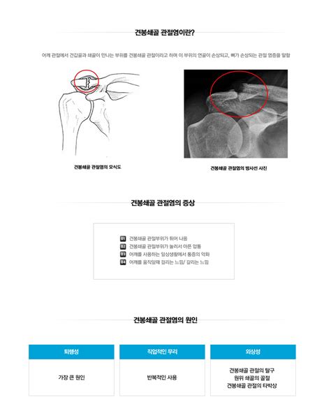 마디사랑병원 질환별 소개 어깨 견봉쇄골 관절염