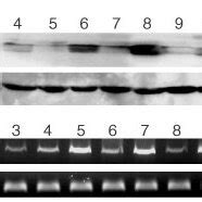 A Western Blot Analysis Of Heparanase Expression In The Human