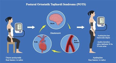 Ortostatik Hipotansiyon Nedir Nasıl Tedavi Edilir Kadinn tr