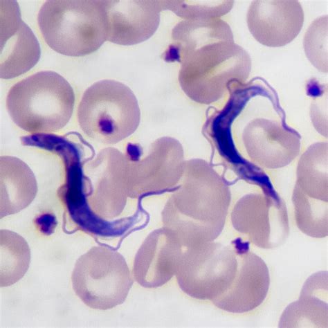 Trypanosoma Blood Smear