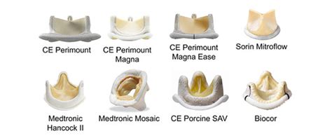 Stented bioprostheses