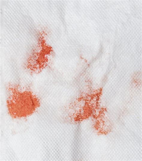 Blood Stains on a White Napkin Stock Photo - Image of dark, contrast ...