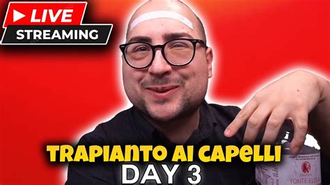 Live Trapianto Ai Capelli La Mia Esperienza Day Del Dicembre