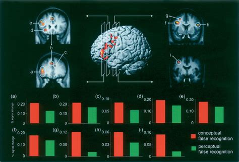 The Neural Correlates Of Conceptual And Perceptual False Recognition