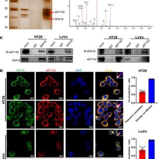 Snx Promotes Tumorigenesis In Mice A Subcutaneous Xenograft Tumor