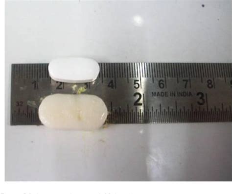 Figure From Development And Characterization Of Gastroretentive