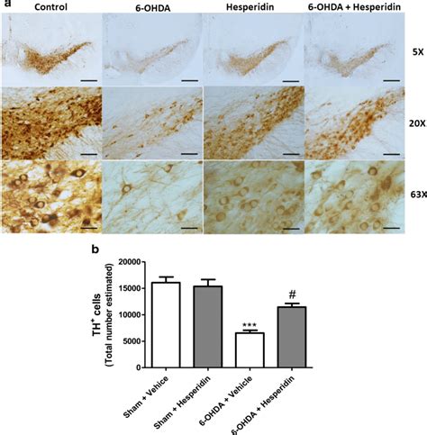 Effect Of Hesperidin Treatment And Intrastriatal Injection Of 6 OHDA On