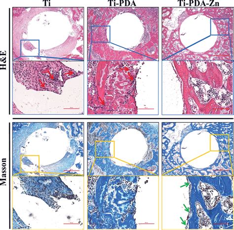 High Magnification Histological Images Of H E And Masson Trichrome