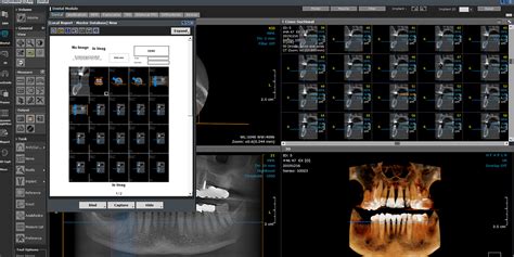 Software De Im Genes D Ondemand D Techdent