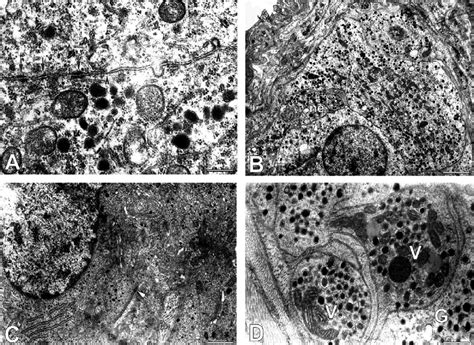 Synaptic Organization Of The Rat Carotid Body Cb A Detail Of The