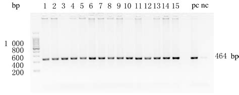 基于CRISPR Cas9技术构建LDLR基因敲除的免疫缺陷小鼠模型及其表型分析