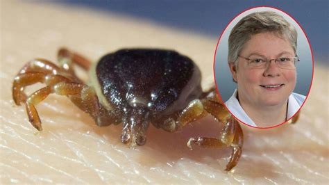 Expertin verrät: So schützt du dich vor Riesenzecken