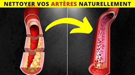 10 meilleurs aliments pour nettoyer et protéger les artères