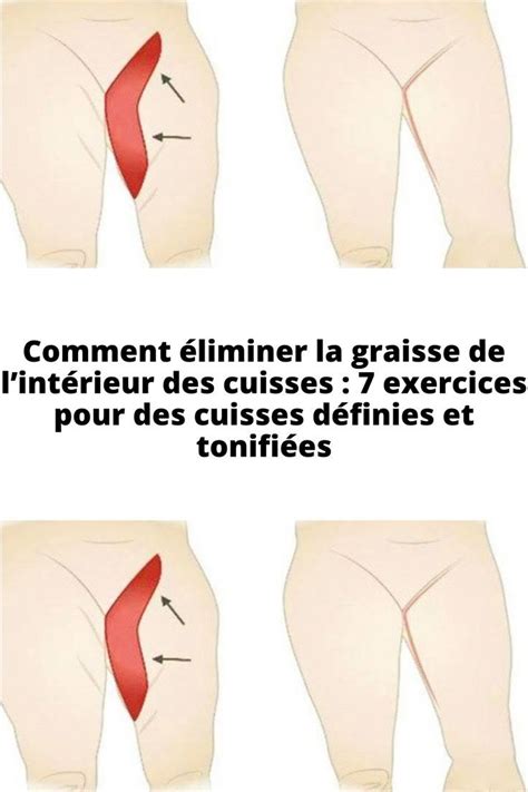 Comment Liminer La Graisse De Lint Rieur Des Cuisses Exercices