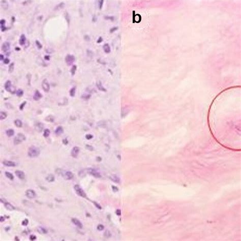 Histopathological Results Of Postoperative Lesions A He Staining