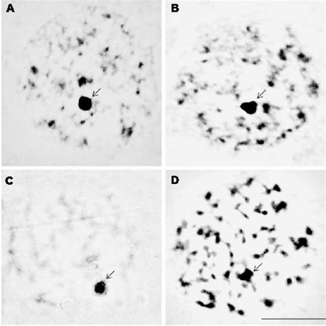 Constitutive Heterochromatin In Spermatocytes Prophase I Of All