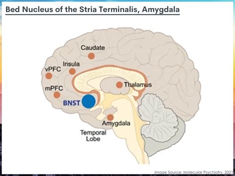 Sex Specific Brain Connectivity During Early Abstinence Implications