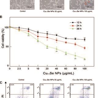 The Toxic Effects Of Cu2xSe NPs On PC 12 Cells A Morphological