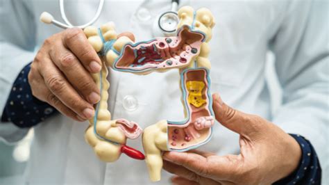 Enfermedad De Crohn S Ntomas Causas Y Tratamientos Actuales