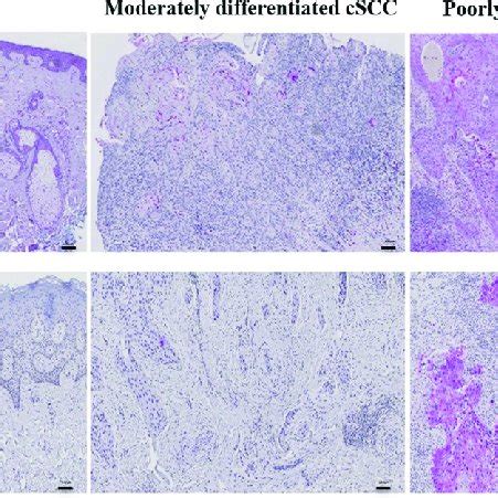 Immunohistochemistry Of MAGE A3 And MAGE A4 Expression In Normal Skin