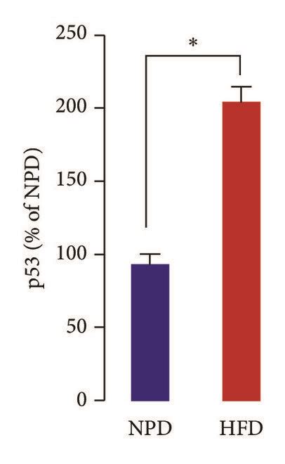 Chronic Hfd Feeding Accelerates Prostatic Aging And Cell Proliferation