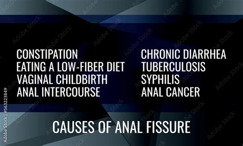Causes Of Anal Fissure Vector Illustration For Medical Journal Or Brochure Stock Vector