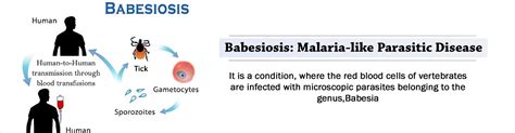 Babesiosis Babesia Causes Symptoms Diagnosis Treatment