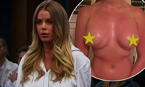 Skye Wheatley Loses Her Court Case On Trial By Kyle After Sharing A Botched Boob Job Photo