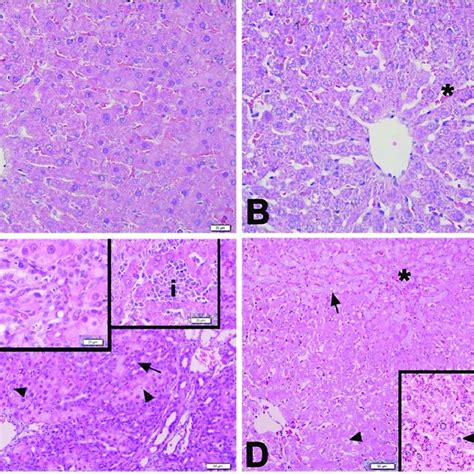 The Representative Light Micrographs Of Liver Samples In Experimental