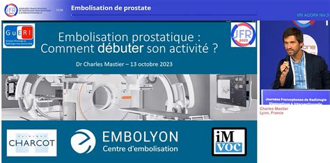 Embolyon Aux Jfr Embolisation De La Prostate