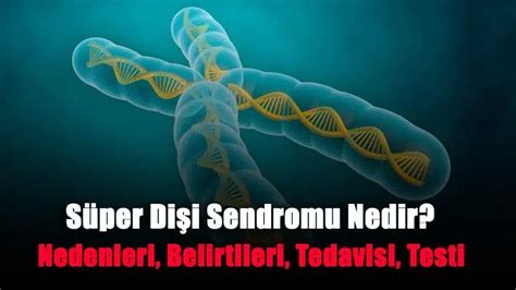 Süper Dişi Sendromu Nedir Nedenleri Belirtileri Tedavisi Testi