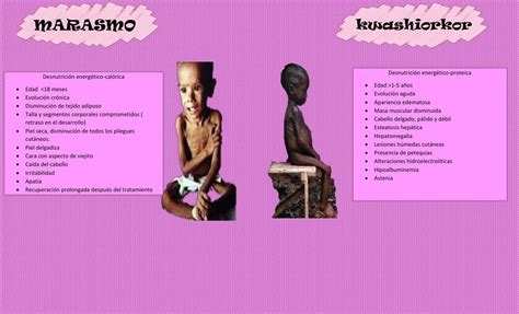 Marasmo E Kwashiorkor Diferença Librain