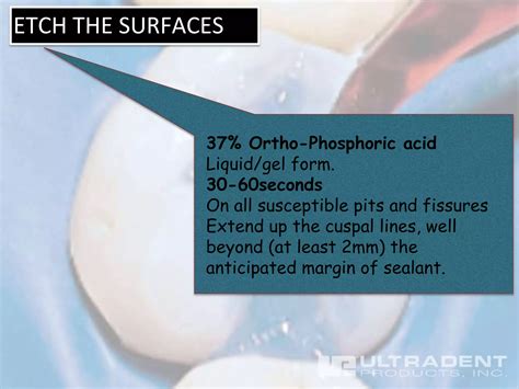 Pit and fissure sealants | PPTX