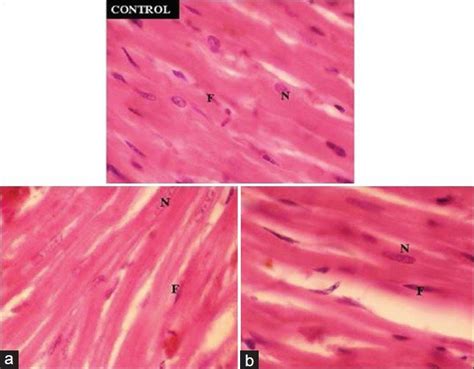 Photomicrographs Of Cardiac Muscle Tissue Magnification H And E